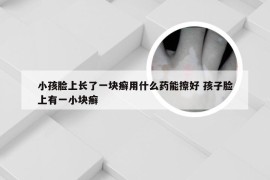 小孩脸上长了一块癣用什么药能擦好 孩子脸上有一小块癣