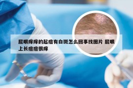屁眼痒痒的起痘有白斑怎么回事找图片 屁眼上长痘痘很痒