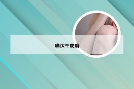 碘伏牛皮癣