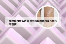 榆林癣用什么药膏 榆林皮肤病医院是几级几等医院