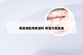 银屑病能喝黄酒吗 黄酒与银屑病
