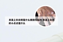 鼻梁上长白斑是什么原因引起的 鼻梁上白色的小点点是什么