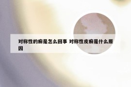 对称性的癣是怎么回事 对称性皮癣是什么原因