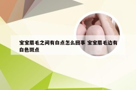 宝宝眉毛之间有白点怎么回事 宝宝眉毛边有白色斑点