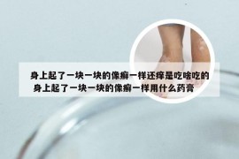 身上起了一块一块的像癣一样还痒是吃啥吃的 身上起了一块一块的像癣一样用什么药膏