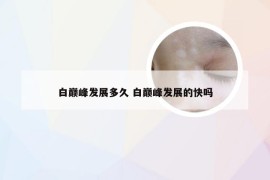 白巅峰发展多久 白巅峰发展的快吗