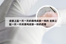 皮肤上起一片一片的像鸡皮肤一样的 皮肤上起一片一片的像鸡皮肤一样的疙瘩
