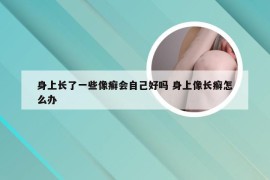 身上长了一些像癣会自己好吗 身上像长癣怎么办