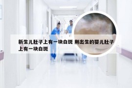 新生儿肚子上有一块白斑 刚出生的婴儿肚子上有一块白斑