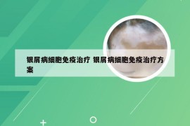 银屑病细胞免疫治疗 银屑病细胞免疫治疗方案