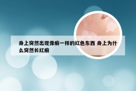 身上突然出现像癣一样的红色东西 身上为什么突然长红癣