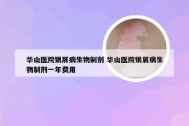 华山医院银屑病生物制剂 华山医院银屑病生物制剂一年费用