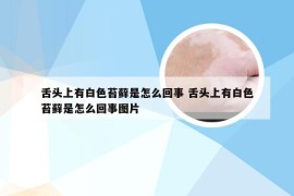 舌头上有白色苔藓是怎么回事 舌头上有白色苔藓是怎么回事图片