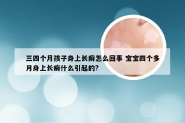 三四个月孩子身上长癣怎么回事 宝宝四个多月身上长癣什么引起的?