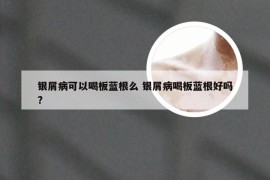 银屑病可以喝板蓝根么 银屑病喝板蓝根好吗?