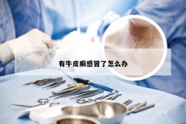 有牛皮癣感冒了怎么办