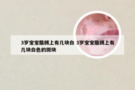 3岁宝宝胳膊上有几块白 3岁宝宝胳膊上有几块白色的斑块