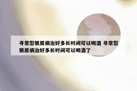 寻常型银屑病治好多长时间可以喝酒 寻常型银屑病治好多长时间可以喝酒了