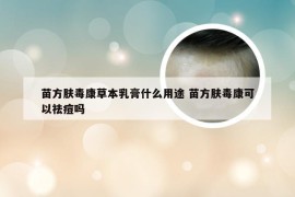 苗方肤毒康草本乳膏什么用途 苗方肤毒康可以祛痘吗