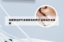 菝葜根治好牛皮癣真实的例子 菝葜治牛皮顽癣