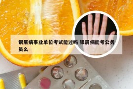 银屑病事业单位考试能过吗 银屑病能考公务员么