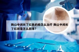 胸口中间长了红色的癣怎么治疗 胸口中间长了红斑是怎么回事?