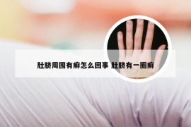 肚脐周围有癣怎么回事 肚脐有一圈癣