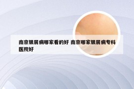 南京银屑病哪家看的好 南京哪家银屑病专科医院好