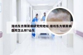 潍坊东方银屑病研究院地址 维坊东方银屑病医院怎么样?山东