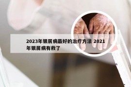 2023年银屑病最好的治疗方法 2021年银屑病有救了