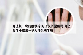 身上长一块疙瘩很痒,好了又长是癣吗 身上起了小疙瘩一块为什么成了癣