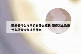 圈癣是什么样子的有什么症状 圈癣怎么治用什么药膏饮食注意什么