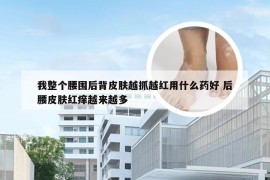 我整个腰围后背皮肤越抓越红用什么药好 后腰皮肤红痒越来越多