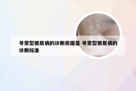 寻常型银屑病的诊断依据是 寻常型银屑病的诊断标准