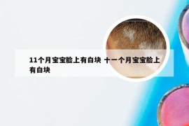 11个月宝宝脸上有白块 十一个月宝宝脸上有白块