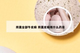 阴囊全部牛皮癣 阴囊皮癣用什么药膏