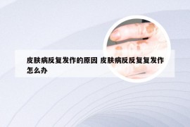 皮肤病反复发作的原因 皮肤病反反复复发作怎么办