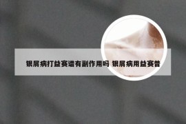 银屑病打益赛谱有副作用吗 银屑病用益赛普