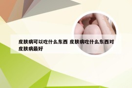 皮肤病可以吃什么东西 皮肤病吃什么东西对皮肤病最好