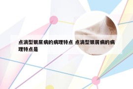 点滴型银屑病的病理特点 点滴型银屑病的病理特点是