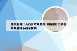 体癣能用什么药膏效果最好 体癣用什么药膏效果最好小孩子用的