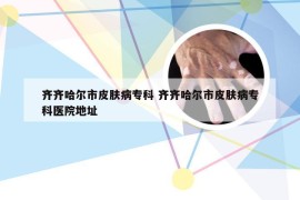 齐齐哈尔市皮肤病专科 齐齐哈尔市皮肤病专科医院地址