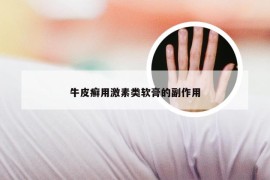 牛皮癣用激素类软膏的副作用