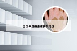 全国牛皮癣患者高发地区