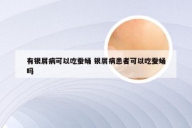 有银屑病可以吃蚕蛹 银屑病患者可以吃蚕蛹吗