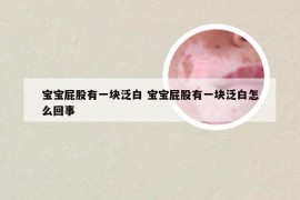 宝宝屁股有一块泛白 宝宝屁股有一块泛白怎么回事