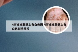 4岁宝宝胳膊上有白色斑 4岁宝宝胳膊上有白色斑块图片