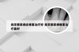 南京银屑病去哪里治疗好 南京银屑病哪里治疗最好