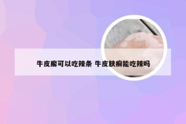 牛皮廨可以吃辣条 牛皮肤癣能吃辣吗