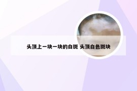 头顶上一块一块的白斑 头顶白色斑块